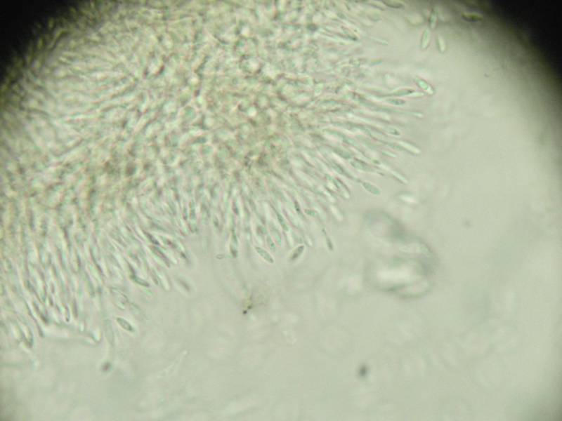 Ancora Tremella?